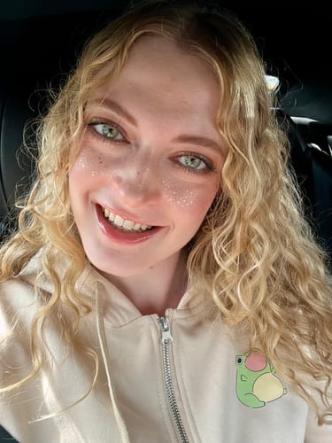 Customer photo review of Gold Glitter Freckles Makeup Patches