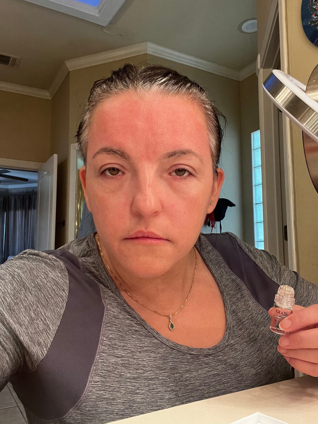 Customer photo review of Système de micro perfusion Glov Beauté