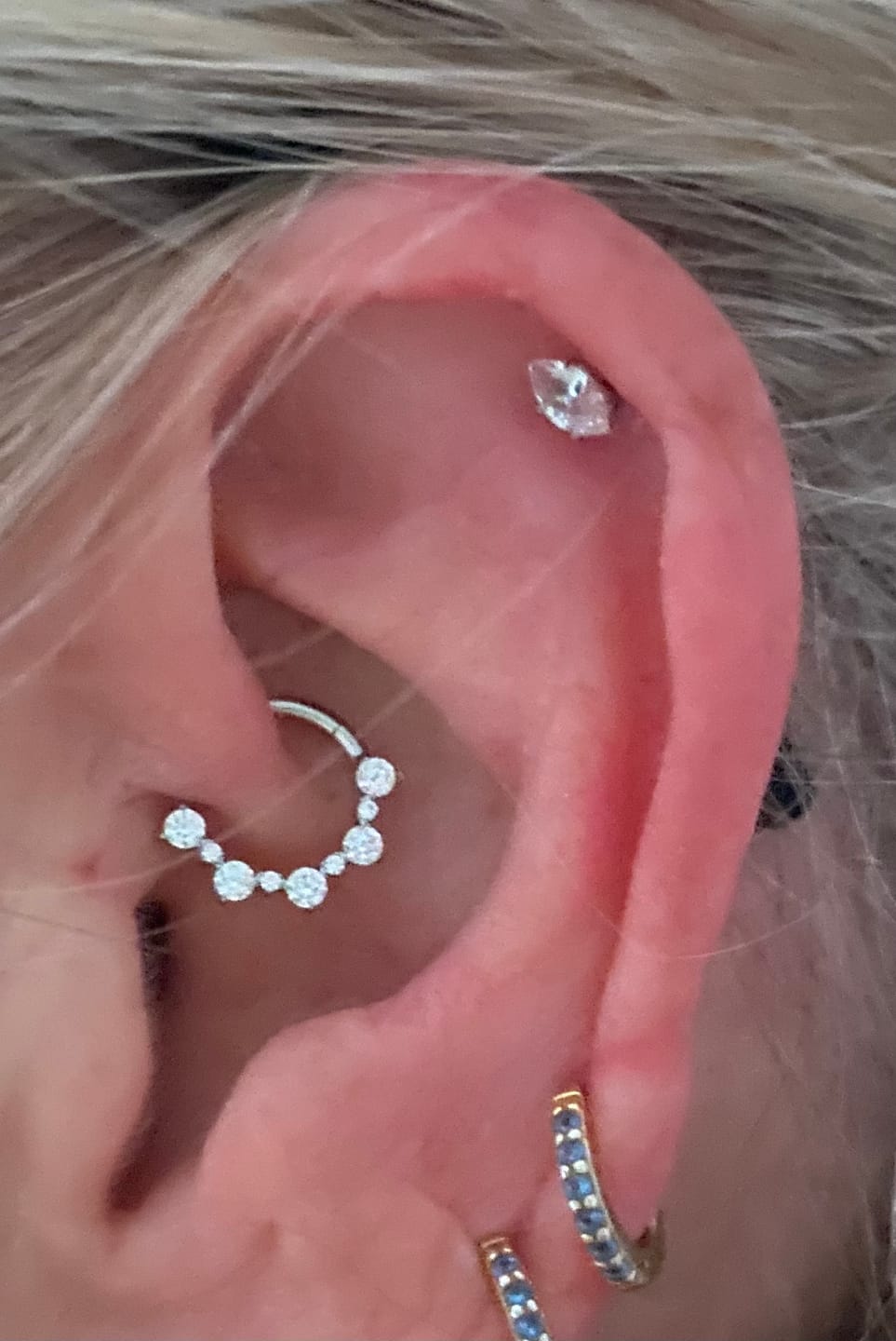 Customer photo review of Labret Insertion Tool (Threadless)