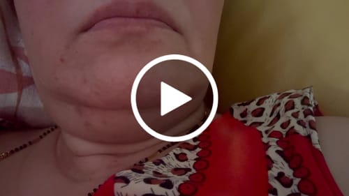 Customer video review of Sea Cucumber Collagen Rescue & Repair Pack
