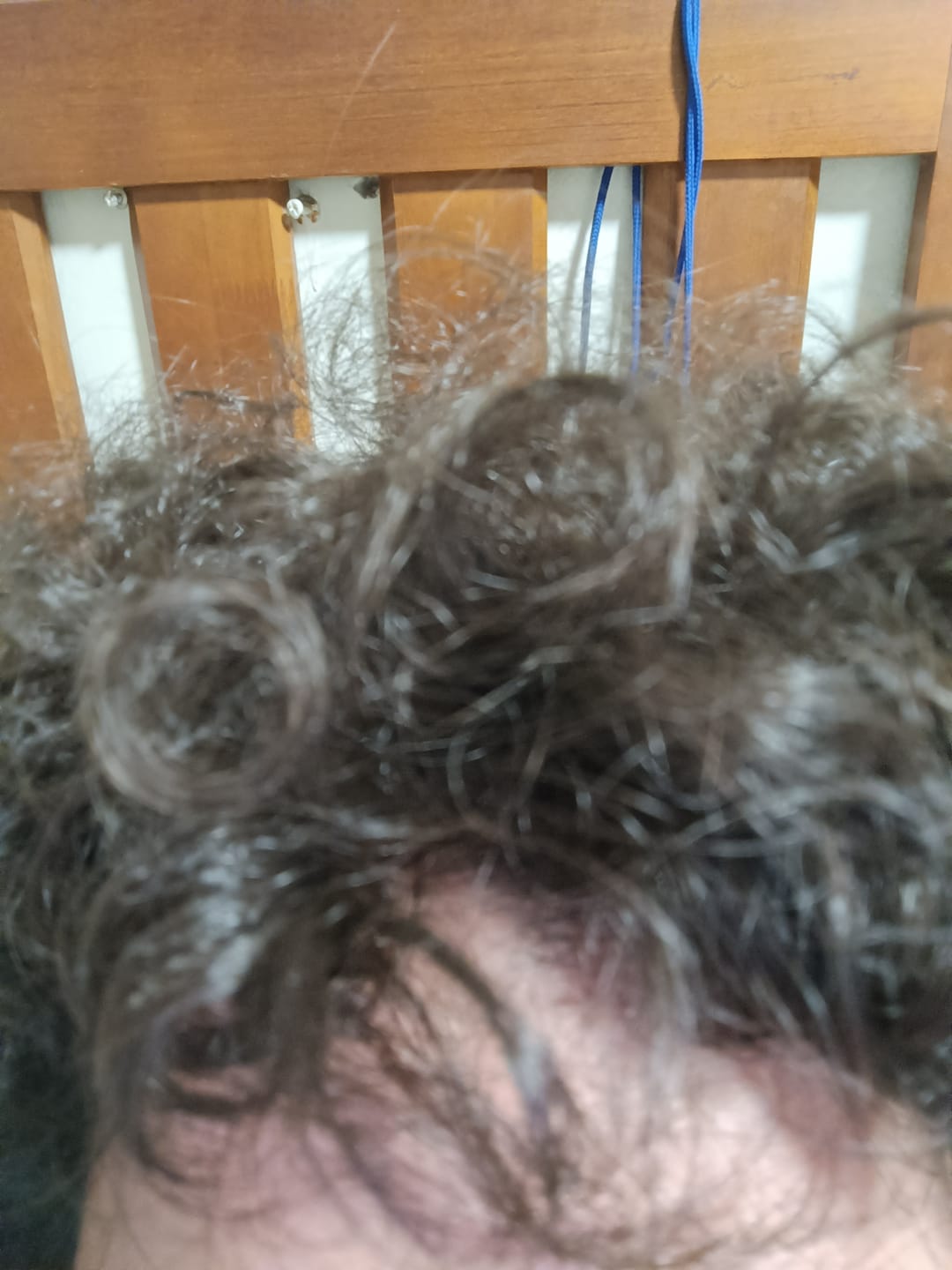 Customer photo review of Tratamiento Anticaída de Pelo para 1 Mes + Biotina