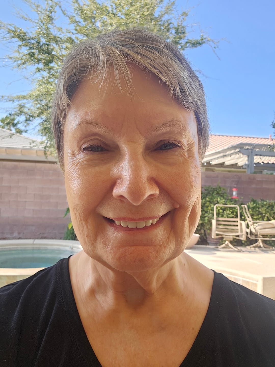 Customer photo review of F3 - DEEP HYDRATING AND PLUMPING SERUM