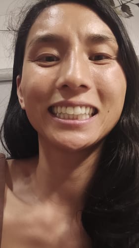 Customer photo review of Premium Lower Retainer