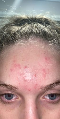 Customer photo review of Skin & Gut Maintain™