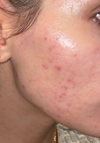 Customer photo review of Sleek Skin Serum 30ml