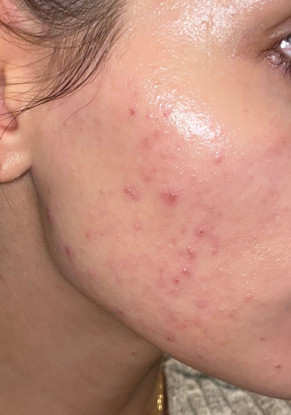 Customer photo review of Sleek Skin Serum 30ml