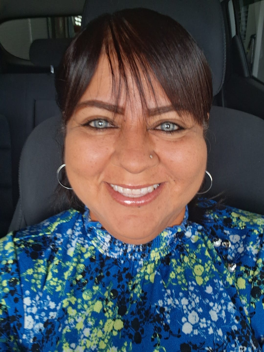 Customer photo review of Himalaya Blue Prescription Colored Contact Lenses