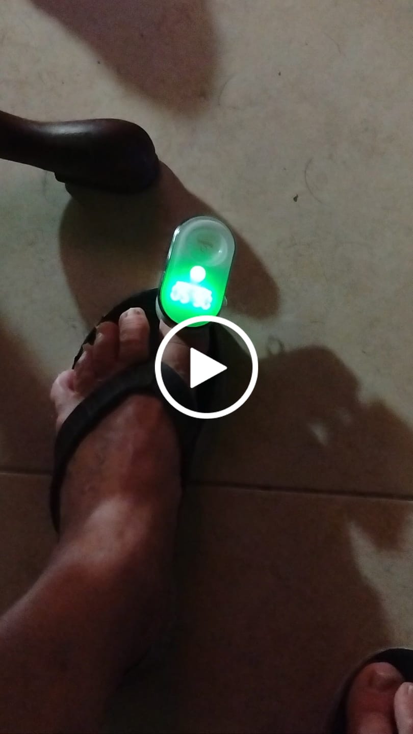Customer video review of Onychom Pro Antifungal LED Device