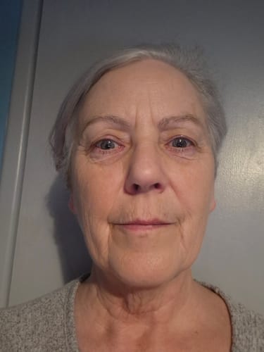Customer photo review of Triple Collagen Booster Drink 15,000mg - LIMITED TIME OFFER