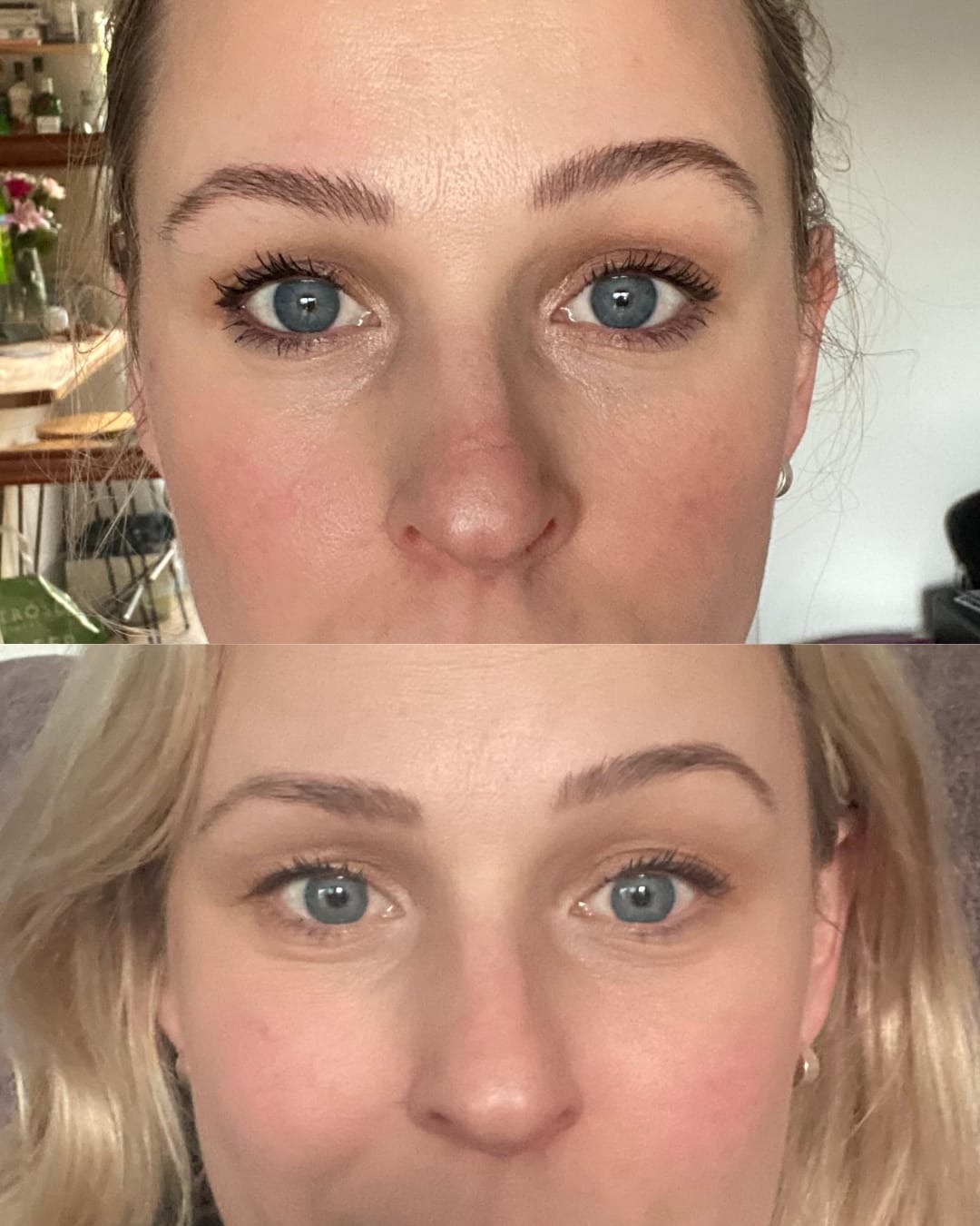 Customer photo review of Bakuchiol Cream