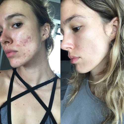 Customer photo review of Zorla™ Tallow & honey Balm