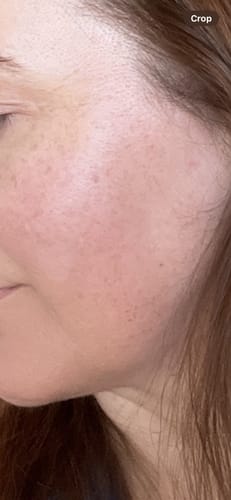 Customer photo review of Sea Cucumber Collagen Regeneration Serum