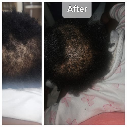 Customer photo review of Infant Collection Kit