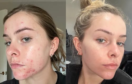 Customer photo review of Zorla™ Tallow & honey Balm