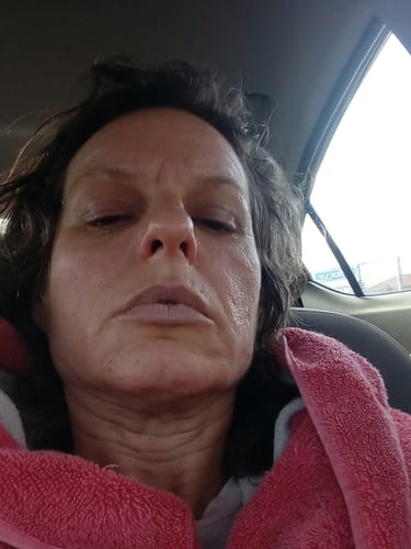 Customer photo review of Glov Micro Infusion System