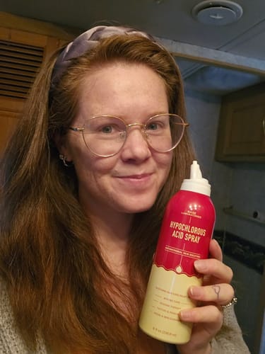 Customer photo review of Hypochlorous Acid Spray for Skin & Face | Cleansing Topical Spray