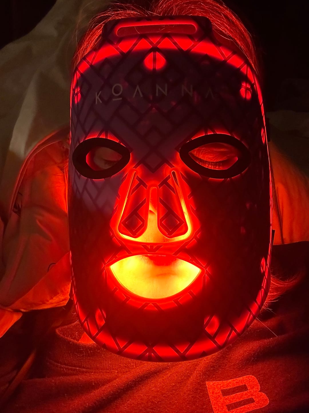 Customer photo review of Koanna® MultiGlo™ LED Light Therapy Mask