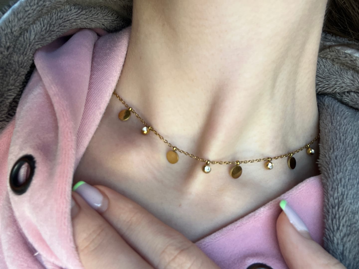 Customer photo review of Lantisor Golden Drops