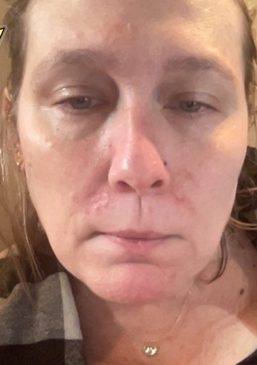 Customer photo review of The Complete System for Mature Women’s Skin