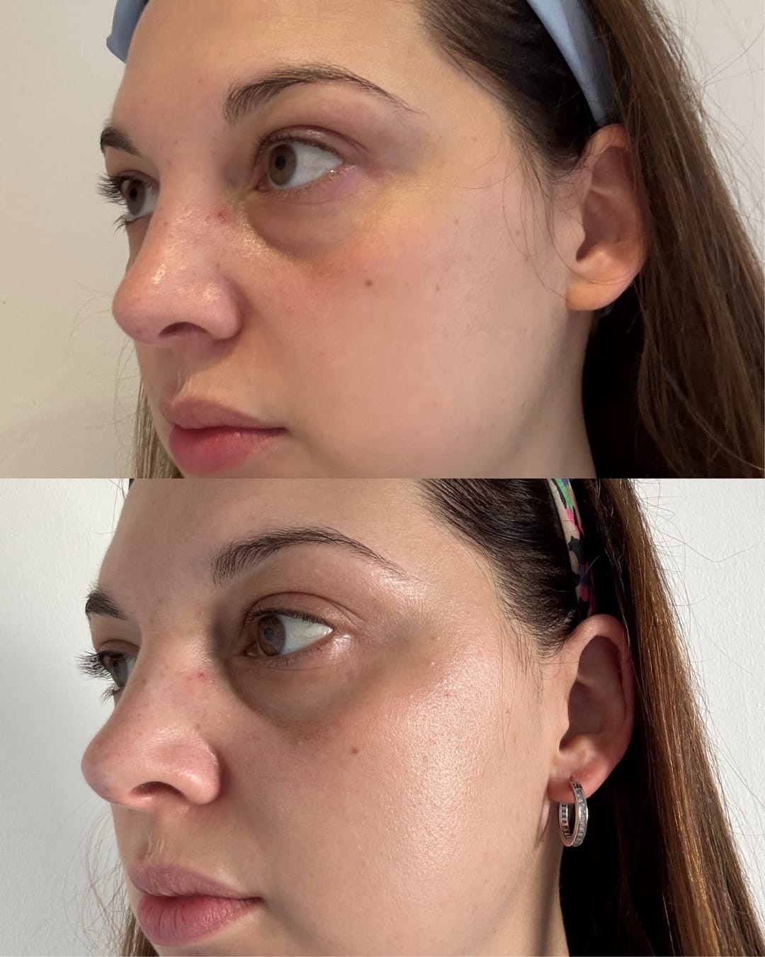 Customer photo review of Bakuchiol Cream