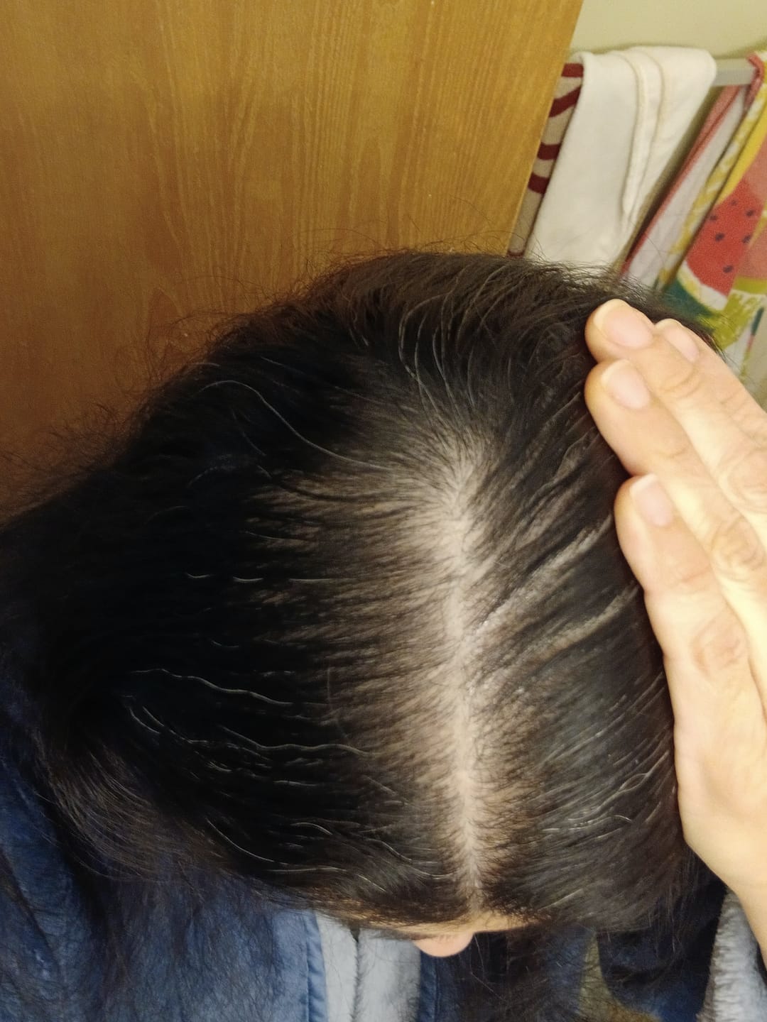 Customer photo review of Rosemary Elixir - 100% Natural Hair Loss Solution