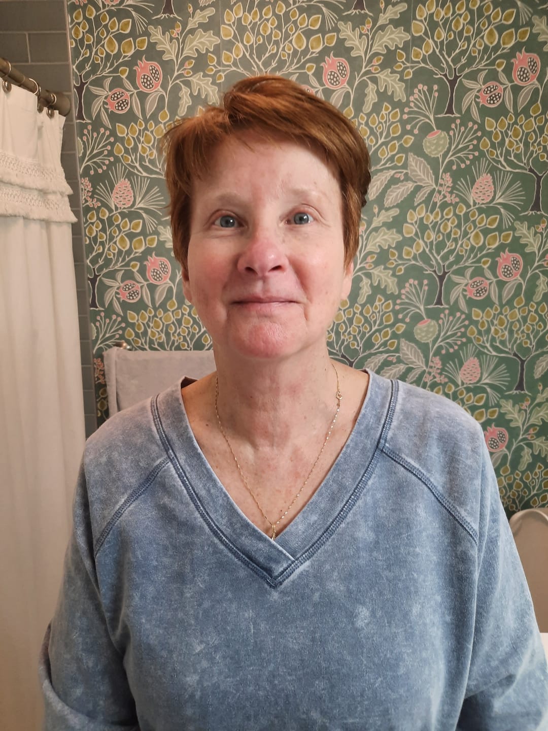 Customer photo review of Rosacea-Ltd IV