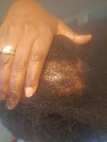 Customer photo review of Red Light Massage Comb