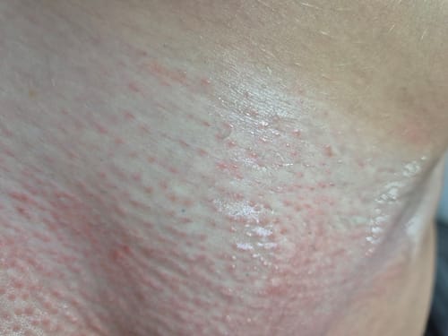 Customer photo review of Fairy Potion