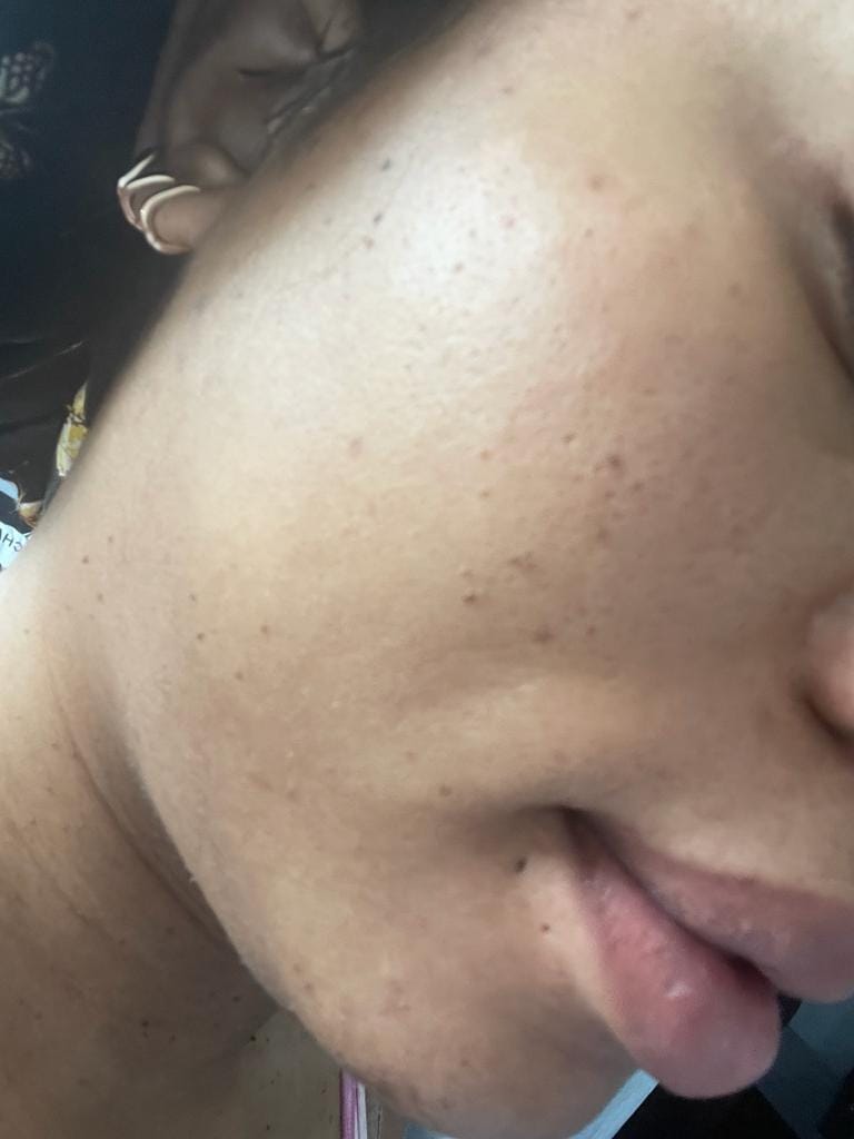 Customer photo review of Organic Oil by Leezsecrets