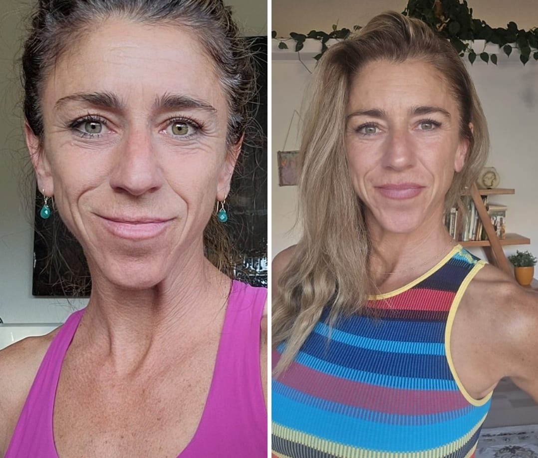 Customer photo review of F3 - DEEP HYDRATING AND PLUMPING SERUM