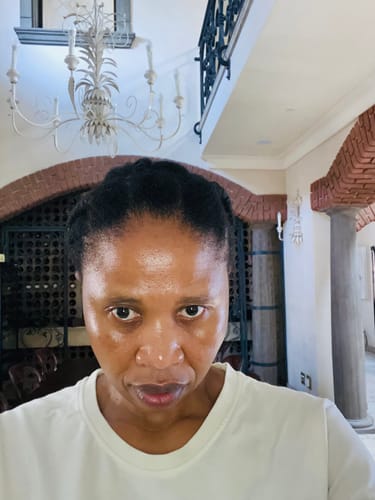 Customer photo review of New Formula: Scalp Serum Set