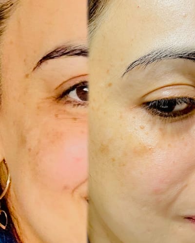 Customer photo review of Vitamin C Suspension 23% + HA Spheres 2%