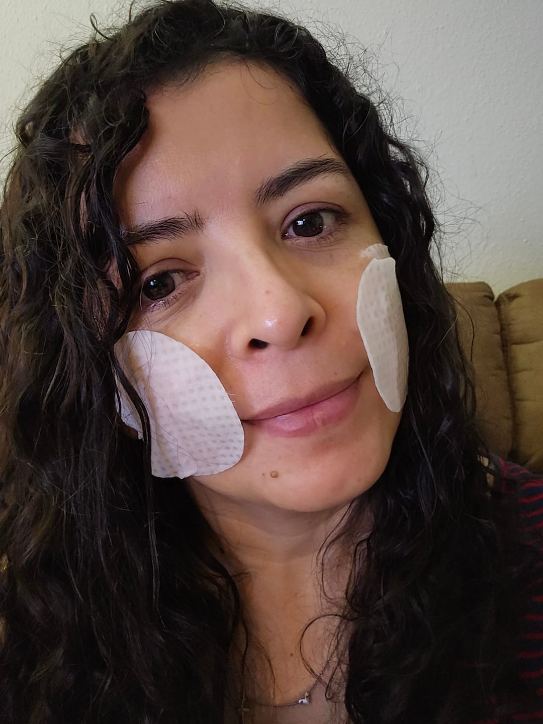 Customer photo review of Jericho rose collagen pad Firming Touch