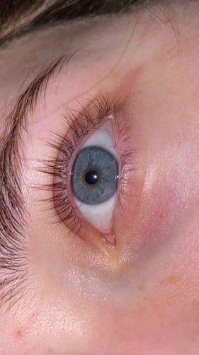 Customer photo review of NEW AND IMPROVED Lash Growth Serum