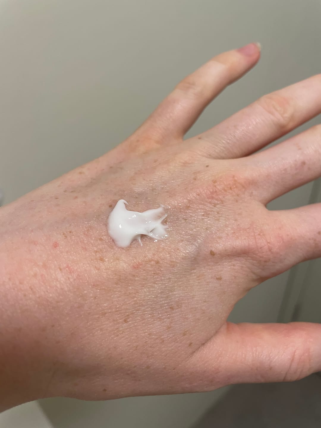 Customer photo review of Peptide + Probiotic Face Cream (New and Improved)
