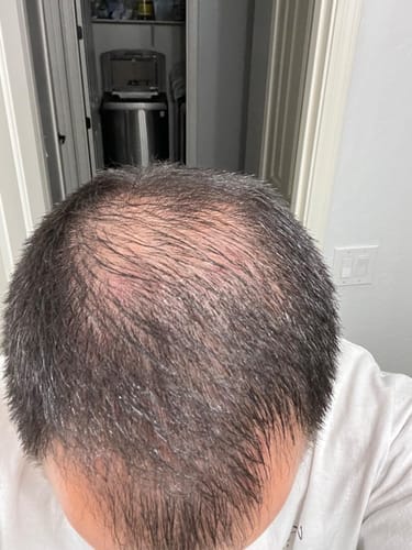 Customer photo review of Smart Scalp Massager