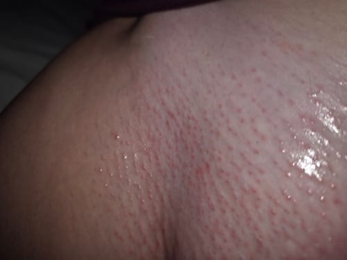 Customer photo review of Fairy Potion