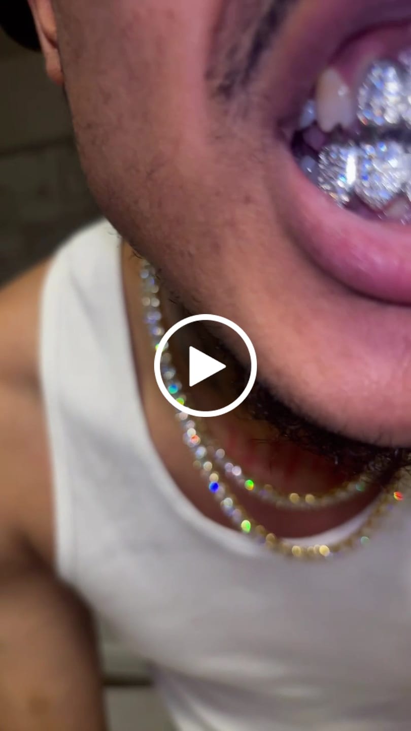 Customer video review of 6 Tooth Thang Iced Grillz - White Gold