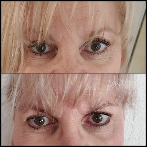 Customer photo review of Happy Skin Set