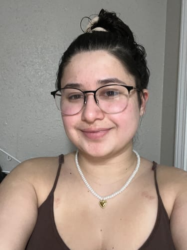Customer photo review of Zylix