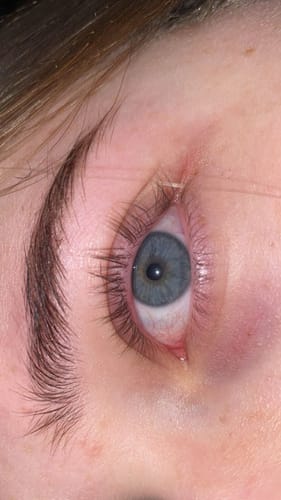 Customer photo review of NEW AND IMPROVED Lash Growth Serum