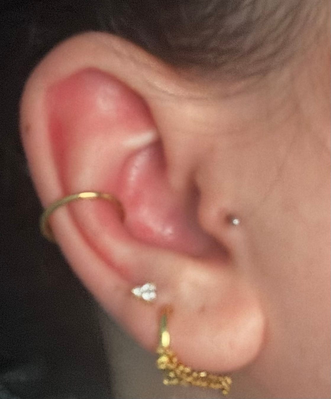 Customer photo review of Basic Segment Hoop (Single)