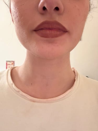 Customer photo review of Lip Over
