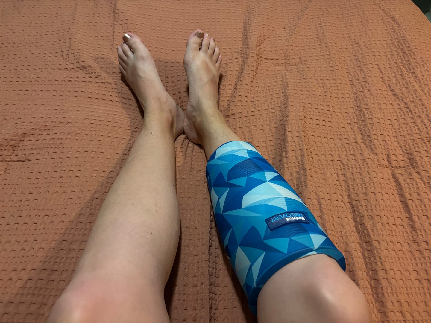 Customer photo review of Medium Hot & Cold Compression Gel Sleeve