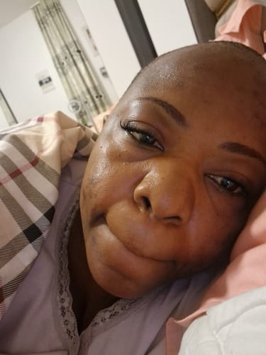 Customer photo review of Forever Young Age Reverse Serum 15 ML