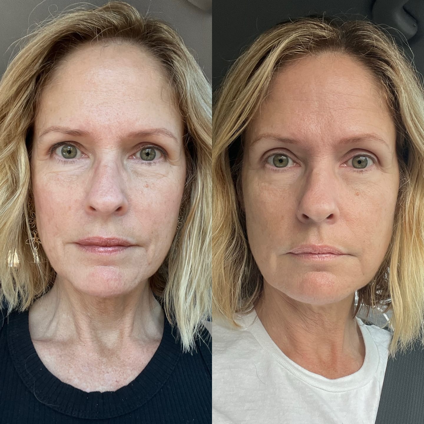 Customer photo review of GLOW RED LIGHT WAND