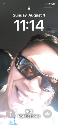 Customer photo review of Rennora Hair Growth Serum