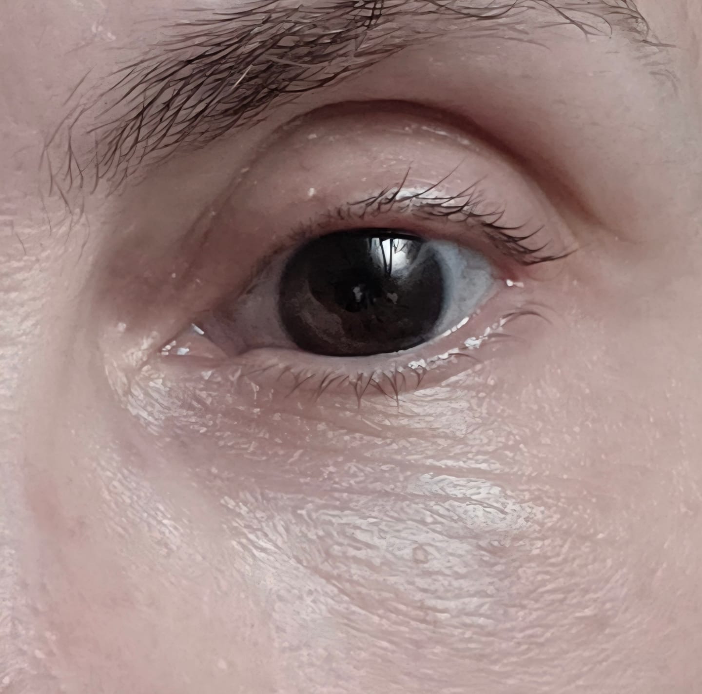 Customer photo review of Hyper Potent Dark Circles & Bag Eye Balm
