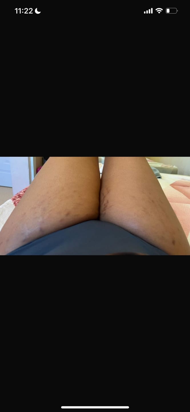 Customer photo review of Organic Oil by Leezsecrets