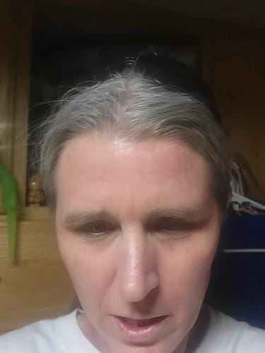 Customer photo review of Glov Micro Infusion System